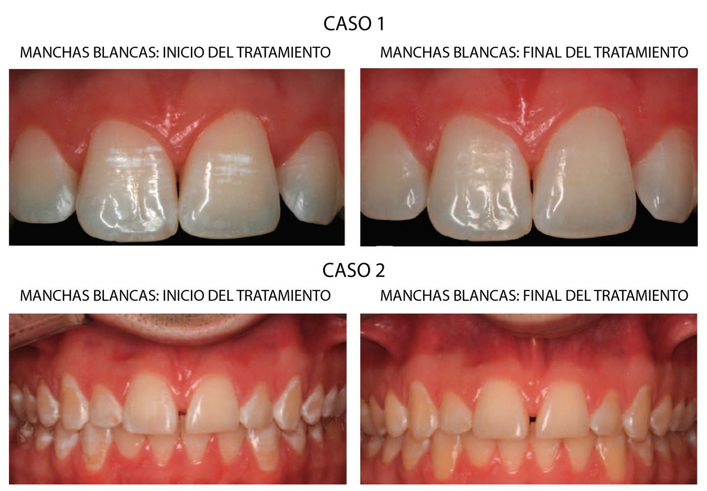 dental morante implantes en madrid