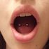 Efectos y complicaciones de los piercings sobre la cavidad oral