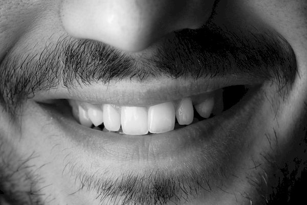 ¿Sabes en qué consiste un blanqueamiento dental?