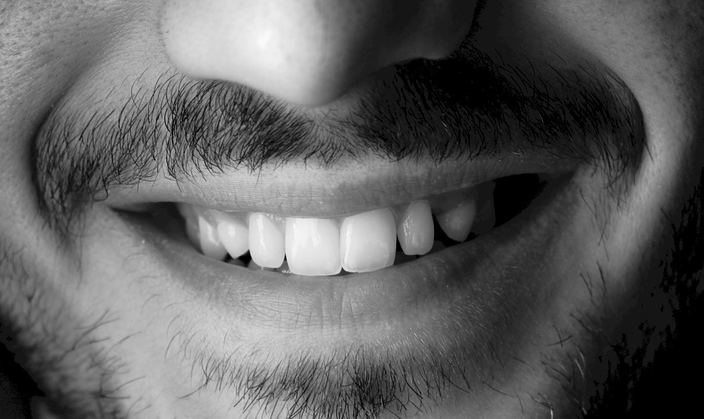 ¿Sabes en qué consiste un blanqueamiento dental?