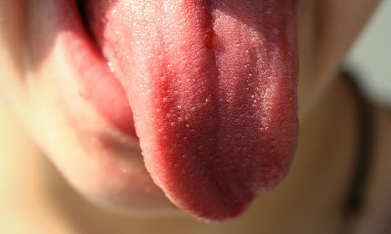 El Síndrome de la Boca Ardiente o Glosodinia. La enfermedad que hace que la lengua queme.