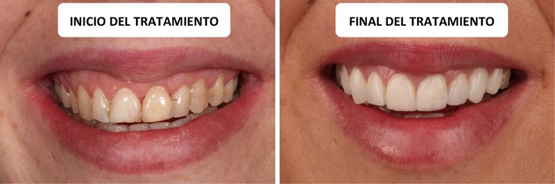 caso clinico estetica dental