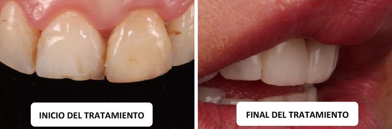 caso clinico estetica dental