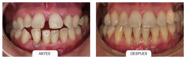 caso clinico ortodoncia