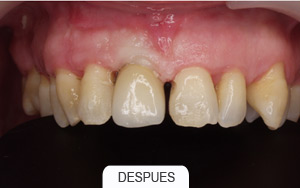 Periodoncia