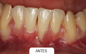 Periodoncia