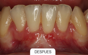 Periodoncia