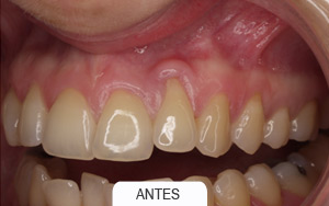 Periodoncia