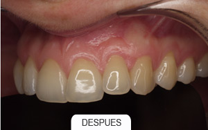 Periodoncia